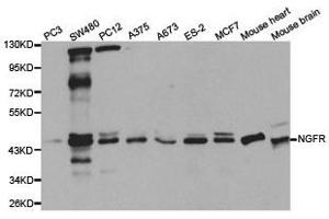 Western Blotting (WB) image for anti-Nerve Growth Factor Receptor (NGFR) antibody (ABIN1873905) (NGFR Antikörper)