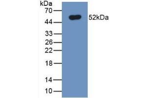 Detection of Recombinant FPN, Human using Monoclonal Antibody to Ferroportin (FPN) (SLC40A1 Antikörper  (AA 127-321))