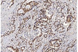 IHC analysis of FEN1 using anti-FEN1 antibody (ABIN7601618). (FEN1 Antikörper  (AA 4-300))