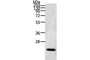 Western Blot analysis of Human fetal brain tissue using CDC42 Polyclonal Antibody at dilution of 1:200 (CDC42 Antikörper)