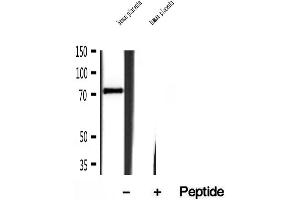 Western blot analysis of extracts of human placenta tissue, using Kindlin 2 antibody. (FERMT2 Antikörper  (C-Term))