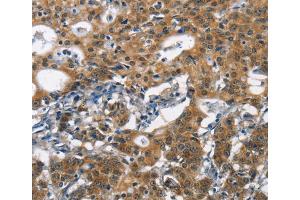 Immunohistochemistry (IHC) image for anti-Deleted in Colorectal Carcinoma (DCC) antibody (ABIN2432000) (DCC Antikörper)