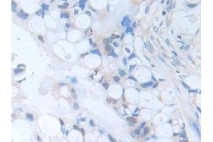 Immunohistochemistry (IHC) image for anti-serpin Peptidase Inhibitor, Clade B (Ovalbumin), Member 9 (SERPINB9) (AA 1-376) antibody (ABIN7435502)