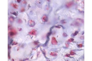 Anti-PTHR / PTHR1 antibody IHC of human bone, fractured callus. (PTH1R Antikörper  (Internal Region))