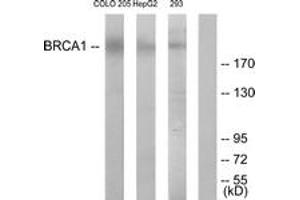 Western blot analysis of extracts from COLO205/HepG2 cells, treated with serum 20% 15', using BRCA1 (Ab-1524) Antibody. (BRCA1 Antikörper  (AA 1491-1540))
