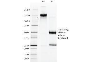 SDS-PAGE Analysis Purified vWF Mouse Monoclonal Antibody (3E2D10). (VWF Antikörper  (AA 845-949))