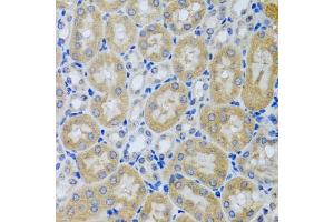 Immunohistochemistry of paraffin-embedded mouse kidney using  antibody (ABIN6127321, ABIN6136446, ABIN6136448 and ABIN6216005) at dilution of 1:100 (40x lens). (ACP1 Antikörper  (AA 1-158))