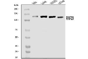 Western blot analysis of RNF20 using anti-RNF20 antibody (ABIN7599860).
