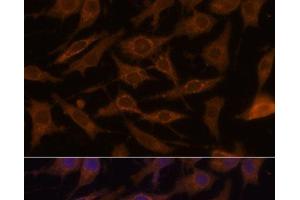Immunofluorescence analysis of L929 cells using UCP1 Polyclonal Antibody at dilution of 1:100. (UCP1 Antikörper)