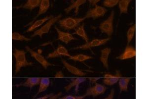 Immunofluorescence analysis of L929 cells using UCP1 Polyclonal Antibody at dilution of 1:100.