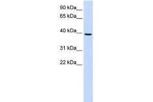 WB Suggested Anti-MOGAT2 Antibody Titration:  0.