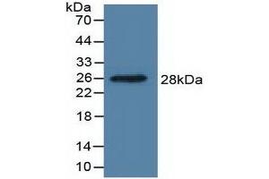 Detection of Recombinant DDAH1, Human using Polyclonal Antibody to Dimethylarginine Dimethylaminohydrolase 1 (DDAH1) (DDAH1 Antikörper  (AA 20-215))
