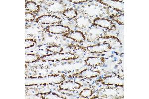 Immunohistochemistry of paraffin-embedded rat kidney using Phospho-FOXO3A-S425 Rabbit pAb (ABIN7267246) at dilution of 1:250 (40x lens).