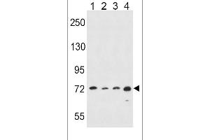Western blot analysis in Hela(lane 1),A549(lane 2),K562(lane 3),MDA-MB435(lane 4) cell line lysates (35ug/lane). (ALOX15 Antikörper  (C-Term))