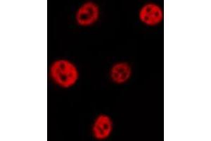 ABIN6277062 staining  HT29 cells by IF/ICC. (FANCD2 Antikörper  (Internal Region))