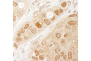 Immunohistochemistry (IHC) image for anti-V-Akt Murine Thymoma Viral Oncogene Homolog 1 (AKT1) (AA 25-75) antibody (ABIN7454546) (AKT1 Antikörper  (AA 25-75))