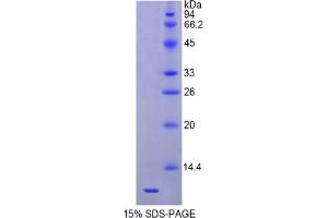 SDS-PAGE analysis of Mouse HSPA8 Protein.