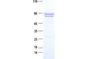 Validation with Western Blot (PTK7 Protein (DYKDDDDK Tag))