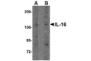 Western blot analysis of IL-16 in rat brain tissue lysate with AP30407PU-N IL-16 antibody at (A) 1 µg/ml and (B) 2 μg/ml. (IL16 Antikörper  (N-Term))