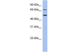 WB Suggested Anti-REPIN1 Antibody Titration:  0. (REPIN1 Antikörper  (Middle Region))