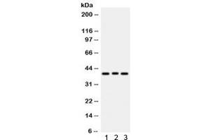 Western blot testing of human 1) COLO320, 2) MCF7 and 3) HeLa cell lysate with WNT2 antibody.
