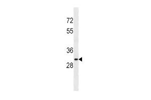 Western Blotting (WB) image for anti-Sulfotransferase Family, Cytosolic, 1A, Phenol-Preferring, Member 2 (SULT1A2) (AA 258-286), (C-Term) antibody (ABIN5537889)