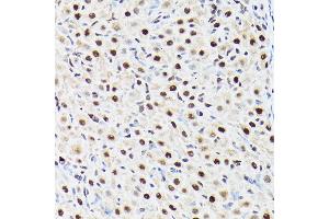 Immunohistochemistry of paraffin-embedded rat ovary using A Rabbit pAb (ABIN6129868, ABIN6136479, ABIN6136480 and ABIN6221034) at dilution of 1:100 (40x lens). (BAF53A Antikörper  (AA 1-280))