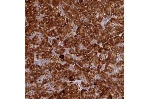 Immunohistochemical staining of human pancreas with C12orf60 polyclonal antibody  shows strong cytoplasmic positivity in exocrine glandular cells at 1:500-1:1000 dilution. (C12orf60 Antikörper)