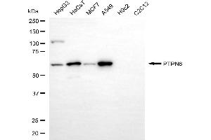 Western blotting analysis using PTPN6 antibody (ABIN7800047).