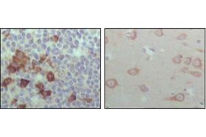 Immunohistochemical analysis of paraffin-embedded human lymph node (left) and brain (right), showing cytoplasmic localization with DAB staining using EhpB6 mouse mAb.