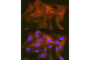 Immunofluorescence analysis of U-2 OS cells using CD172a/SIRPα Rabbit mAb (ABIN7270316) at dilution of 1:100 (40x lens). (SIRPA Antikörper)