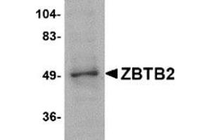 Western blot analysis of ZBTB2 in PC-3 cell lysate with this product at 1 μg/ml. (ZBTB2 Antikörper  (Center))