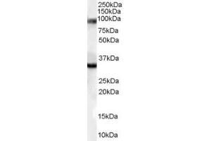 Western Blotting (WB) image for anti-Bone Morphogenetic Protein 8A (BMP8A) (Middle Region) antibody (ABIN2789951) (BMP8A Antikörper  (Middle Region))