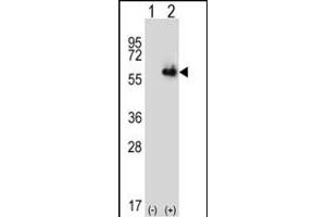 Western blot analysis of ALDH4A1 (arrow) using rabbit polyclonal ALDH4A1 Antibody (Center) (ABIN392357 and ABIN2841996). (ALDH4A1 Antikörper  (AA 288-314))