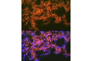 Immunofluorescence (IF) image for anti-Mesothelin (MSLN) antibody (ABIN7268478)