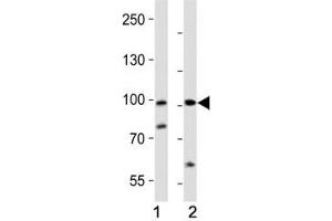 Western blot analysis of lysate from (1) human A2058 and (2) rat PC-12 cell line using PROX1 antibody at 1:1000. (PROX1 Antikörper  (AA 492-522))