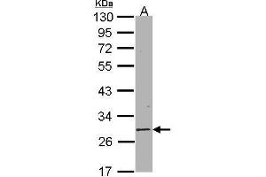 WB Image Sample(30 μg of whole cell lysate) A:Hep G2, 10% SDS PAGE antibody diluted at 1:1000 (SIRT3 Antikörper  (C-Term))