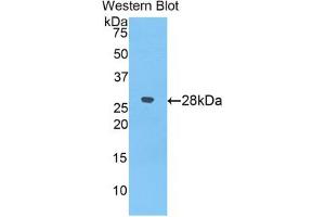 Western blot analysis of the recombinant protein. (alpha 2 Macroglobulin Antikörper  (AA 157-389))
