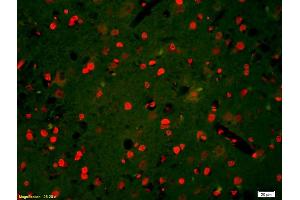 Formalin-fixed and paraffin-embedded rat brain labeled with Anti-Phospho-HER3(Tyr1328) Polyclonal Antibody, Unconjugated (ABIN800628) 1:200, overnight at 4°C, The secondary antibody was Goat Anti-Rabbit IgG, Cy3 conjugated used at 1:200 dilution for 40 minutes at 37°C. (ERBB3 Antikörper  (pTyr1328))