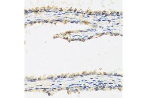 Immunohistochemistry of paraffin-embedded human prostate using SPINT1 antibody at dilution of 1:100 (40x lens). (SPINT1 Antikörper)