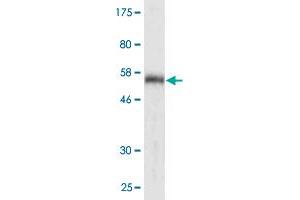 Western Blot detection against Immunogen (58. (CDK2 Antikörper  (AA 1-298))