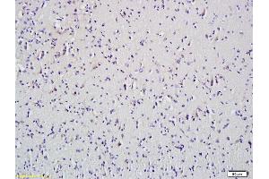 Formalin-fixed and paraffin embedded mouse spleen tissue labeled with Anti-HDAC5 Polyclonal Antibody, Unconjugated (ABIN681043) at 1:200 followed by conjugation to the secondary antibody and DAB staining (HDAC5 Antikörper)