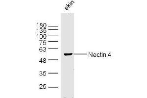Mouse skin lysates probed with Nectin 4 Polyclonal Antibody, Unconjugated  at 1:300 dilution and 4˚C overnight incubation. (PVRL4 Antikörper  (AA 151-250))