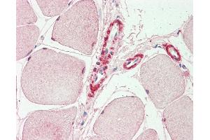 Anti-INPP5K / SKIP antibody IHC staining of human skeletal muscle. (INPP5K Antikörper  (AA 183-430))