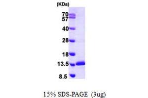 SDS-PAGE (SDS) image for Small Nuclear Ribonucleoprotein Polypeptide E (SNRPE) (AA 1-92) protein (His tag) (ABIN6386697) (SNRPE Protein (AA 1-92) (His tag))