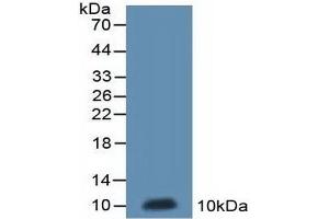Detection of Recombinant ND5, Rat using Polyclonal Antibody to NADH Dehydrogenase 5 (ND5) (MT-ND5 Antikörper  (AA 425-562))