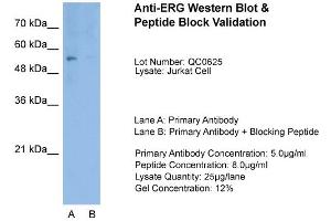 Host:  Rabbit  Target Name:  ERG  Sample Type:  Jurkat  Lane A:  Primary Antibody  Lane B:  Primary Antibody + Blocking Peptide  Primary Antibody Concentration:  1. (ERG Antikörper  (Middle Region))