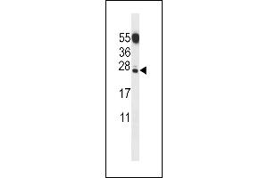 C Antibody (N-term) (ABIN656853 and ABIN2846058) western blot analysis in mouse testis tissue lysates (35 μg/lane). (CT011 Protein Antikörper  (N-Term))