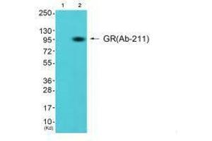 Western blot analysis of extracts from K562 cells (Lane 2), using GR (Ab-211) antiobdy. (Glucocorticoid Receptor Antikörper  (Ser211))
