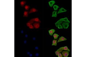 Phospho-JIP1 (Thr103) Antibody staining Hela cells(heat shock treatment) by IF/ICC. (MAPK8IP1 Antikörper  (pThr103))